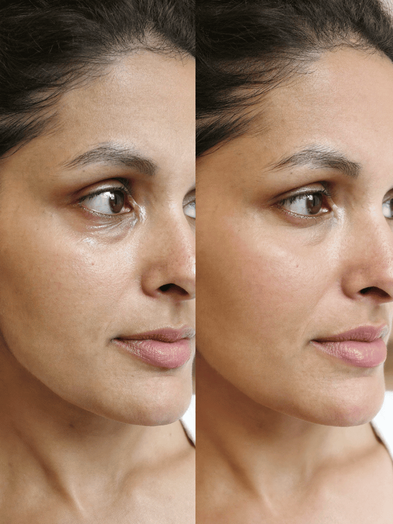 ForeverYoung™ Glow Balm Stick