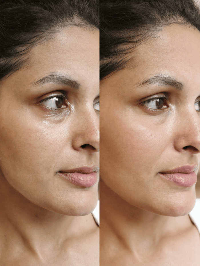 — Harini, 31, Bangalore