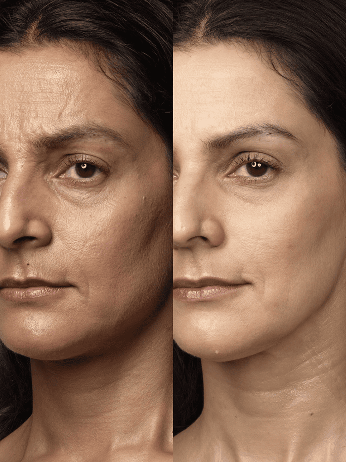 — Meera, 38, Chennai